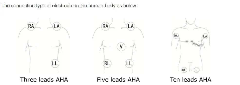 Kompatibel Bionet BM3 BM5 EKG-kabel i ett stycke med blytrådar, AHA, 3-bly, snap, röd 12pin